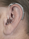補聴器　相模原